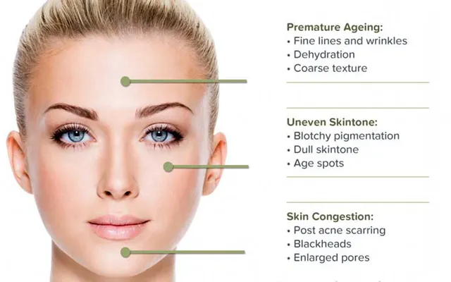 Microdermabraziune