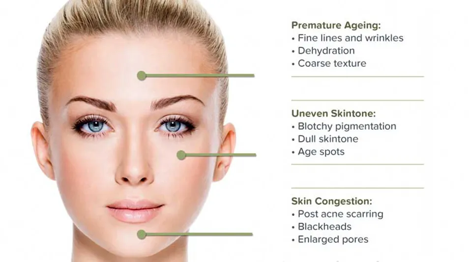 Microdermabraziune — Deea Body Center Ploiești