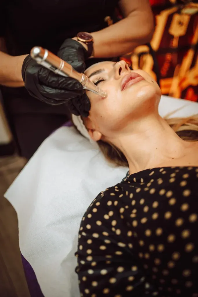 Tratament facial MicroPen Deea Body Center Ploiești
