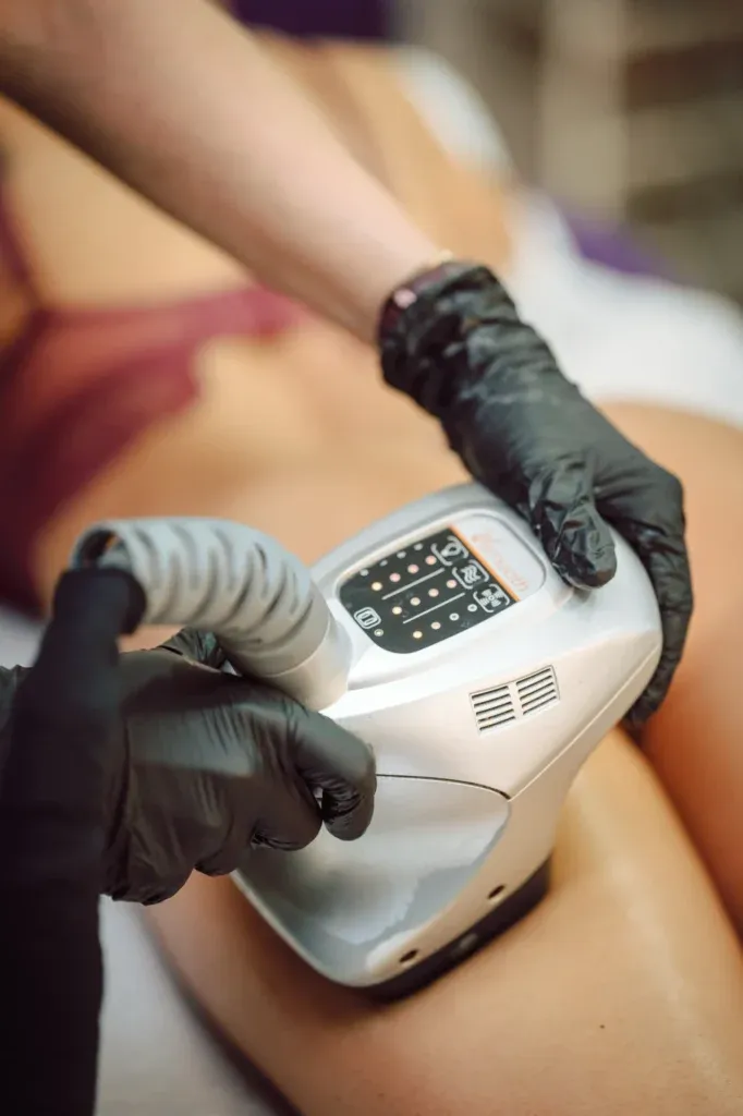 Tratare celulită Deea Body Center Ploiești